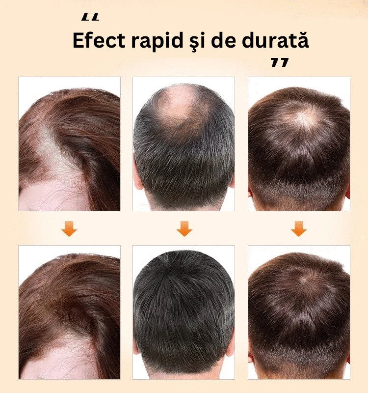 Tratament pentru creșterea părului și stoparea căderii cu plante medicinale