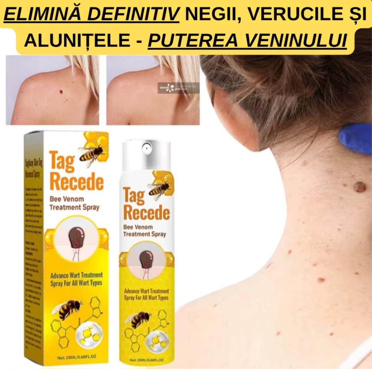 Spray cu Venin de Albine pentru Eliminarea Negilor, Verucilor și Alunițelor